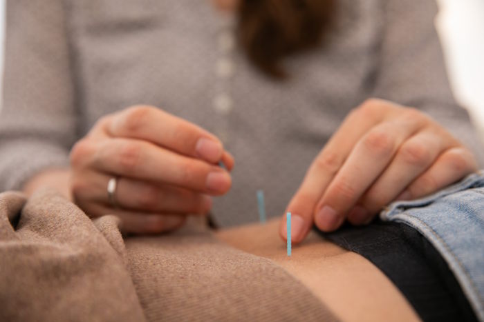 Akupunktur, durchgeführt von Verena Gruber